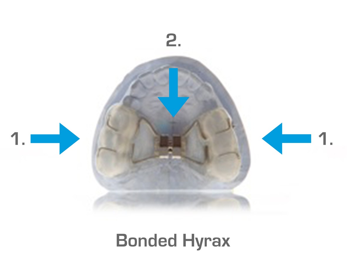 Bonded Hyrax