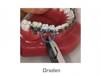 Draden (boven- en onderkaak) | 1. Een draad is te lang: u kunt proberen met een nagelknipper deze af te knippen. Wanneer dit niet lukt en voor ernstige problemen zorgt kunt u het noodnummer bellen. 2. Een draad heeft losgelaten: u kunt proberen met een nagelknipper deze af te knippen. Wanneer dit niet lukt en voor ernstige problemen zorgt kunt u het noodnummer bellen. 3. Indien draden die storen op een eenvoudige wijze te verwijderen zijn: bij reguliere openingstijden een afspraak maken.