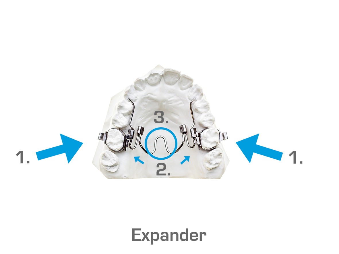 Expander