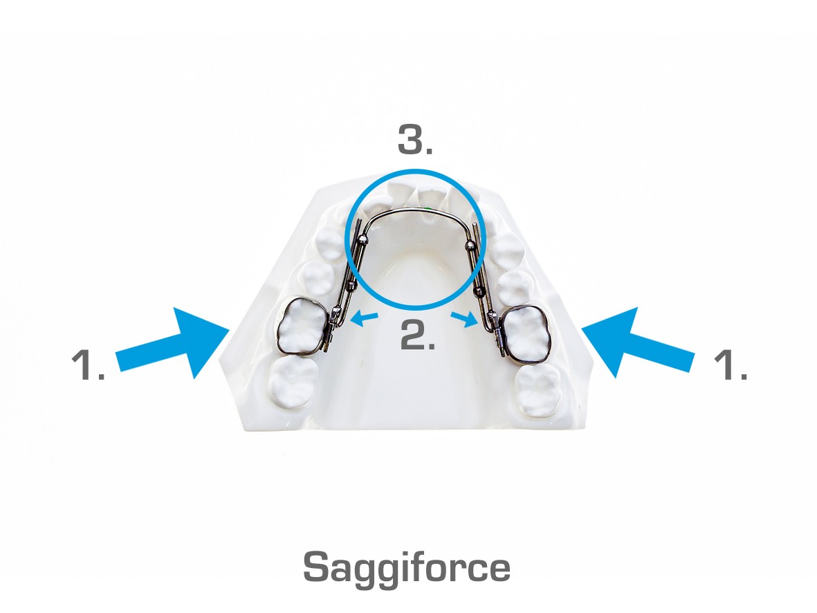 Saggiforce