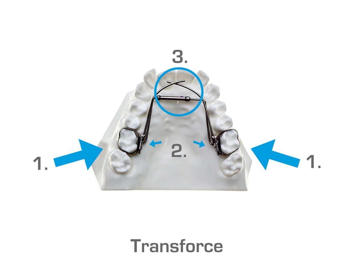 Transforce